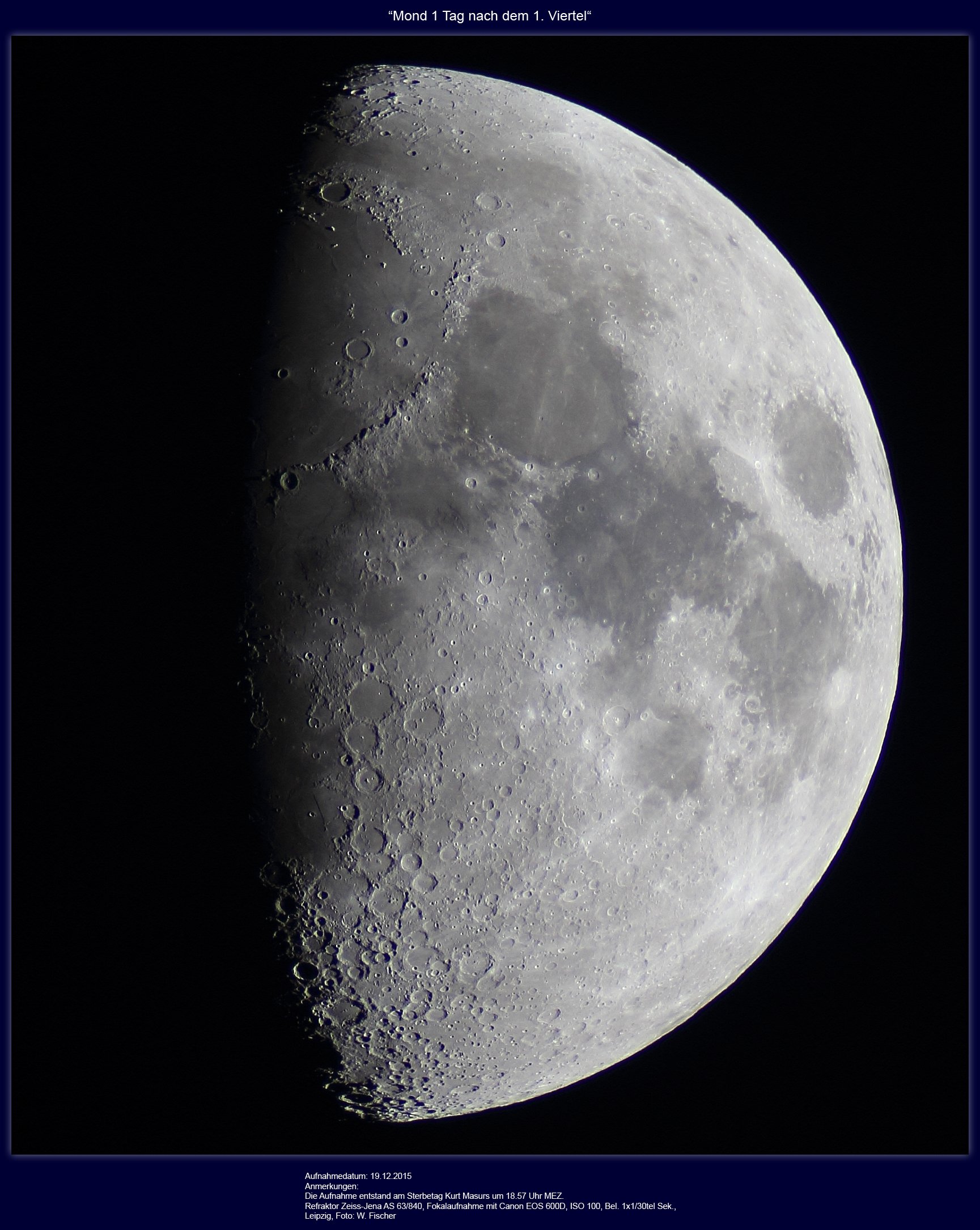 20151219.R63.Mond